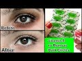 Remove Dark Circles in 3 days with Vitamin- E (100% Works)