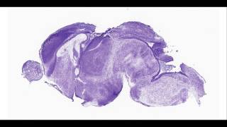 mouse brain - P1 sagittal