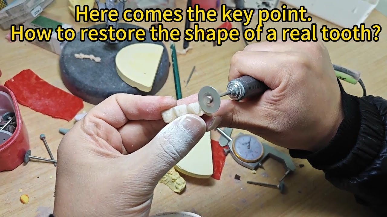 Explore a Step in the Denture Making Process@denture fabrication