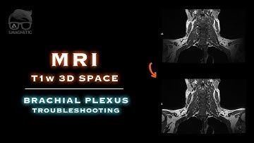 MRI – T1w 3D SPACE – BRACHIAL PLEXUS