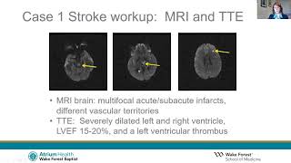 Stroke and Pregnancy