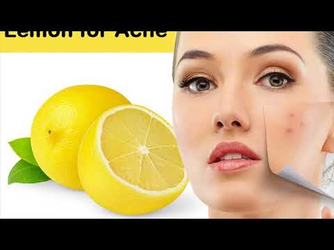 Natural Acne-Fighting Ingredient During Pregnancy Is Lemon- How To Use