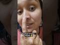 Developer Tester Pimples #shorts