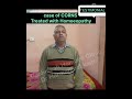 Testimonial #homeopathy #treatmentofcornswithhomeopathy #corns #cornstreatment