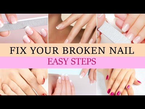 How to Fix a Broken Nail? Easy Broken Nail Repair