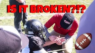 A look at what i do to get ready for my little league football games.
this game was bad one because ended up getting hurt pretty and the emt
had c...