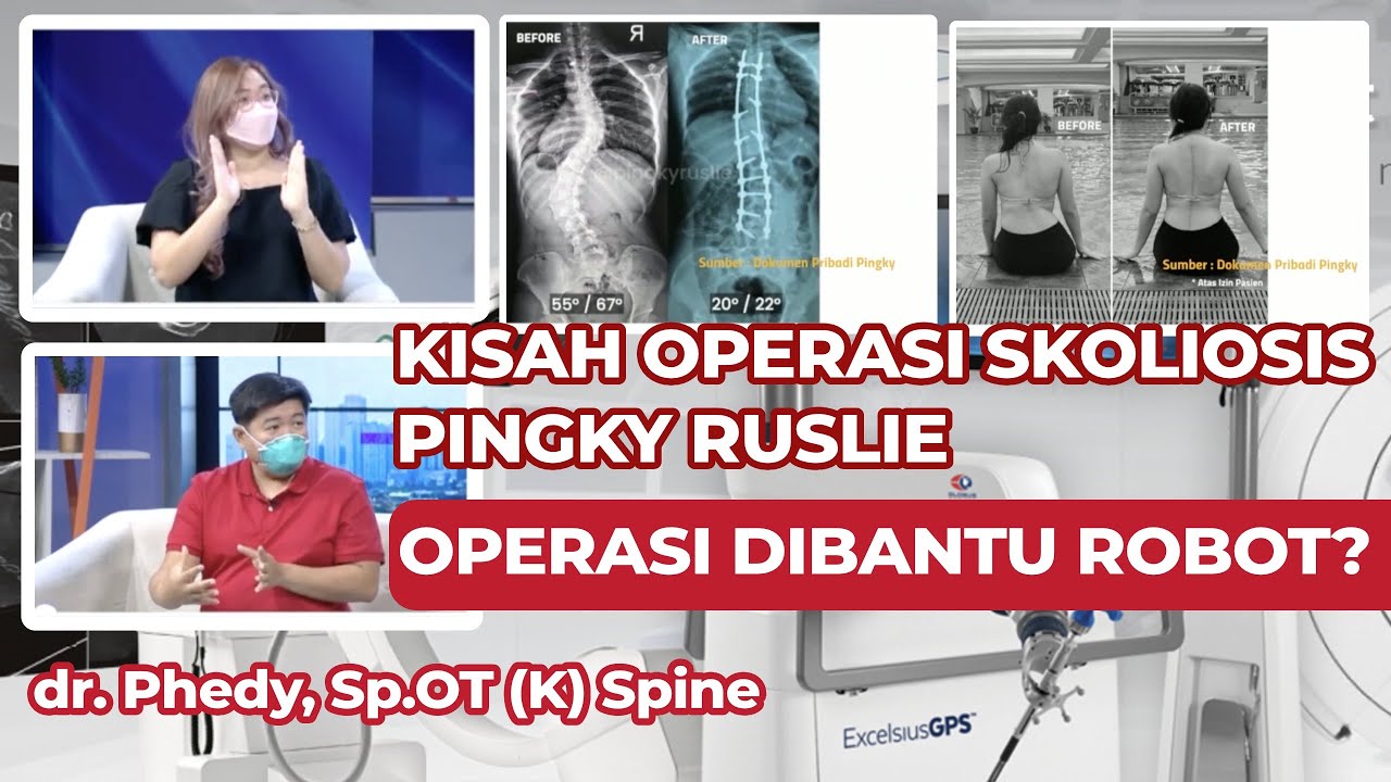 PENGOBATAN ALTERNATIF SKOLIOSIS & ROBOTIK NAVIGASI | GATAM INSTITUTE | dr. Phedy, Sp.OT (K) Spine