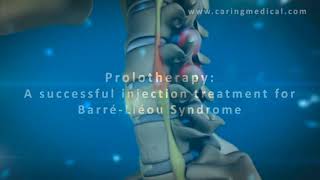 3D animation demonstrating Prolotherapy for Barré-Liéou Syndrome and cervical spine instability