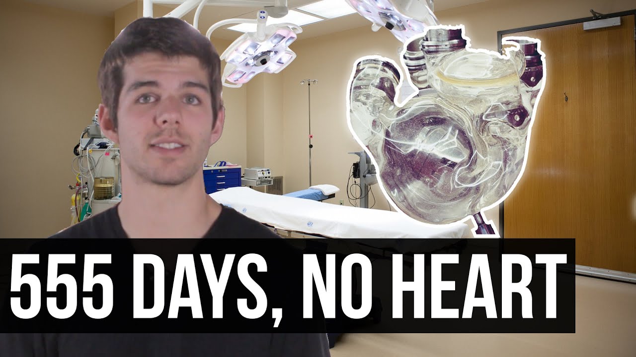How one man lived 555 days with no biological heart - As always, please like/share/comment/subscribe if you enjoyed the video, and let me know what you think of the video in the comments below!