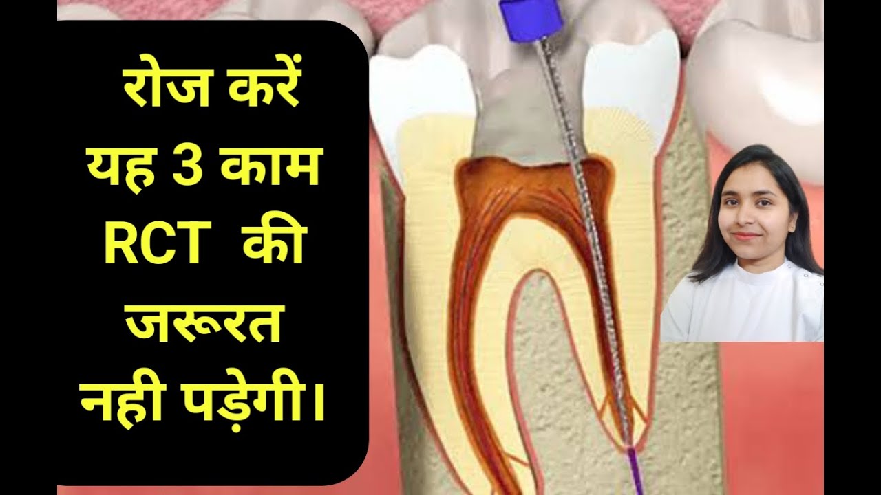 रोज करें तीन काम आईसीटी की जरूरत नहीं पड़ेगी। How to prevent RCT - YouTube