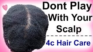 Product Buildup on Natural Hair | How to Get Rid of Buildup on Hair/Scalp