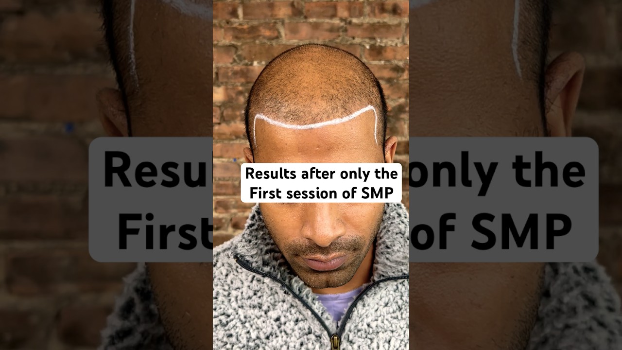 What to expect after first SMP Session?