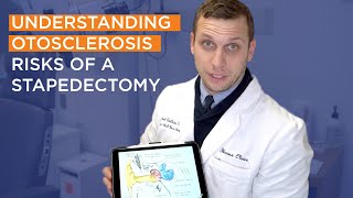 Understanding Otosclerosis Part 7 | What are the Risks of a Stapedectomy? by House Institute 3,217 views 1 year ago 4 minutes, 38 seconds