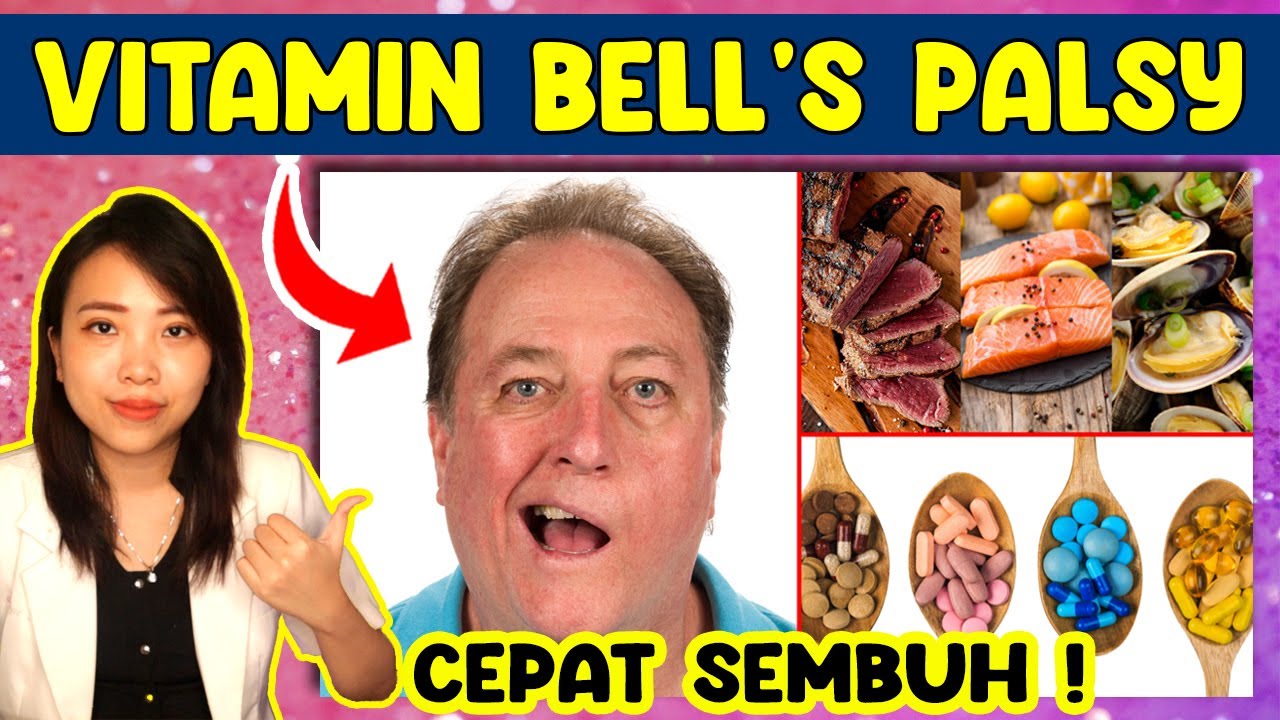 BELL’S PALSY CEPAT SEMBUH TOTAL DENGAN VITAMIN INI !