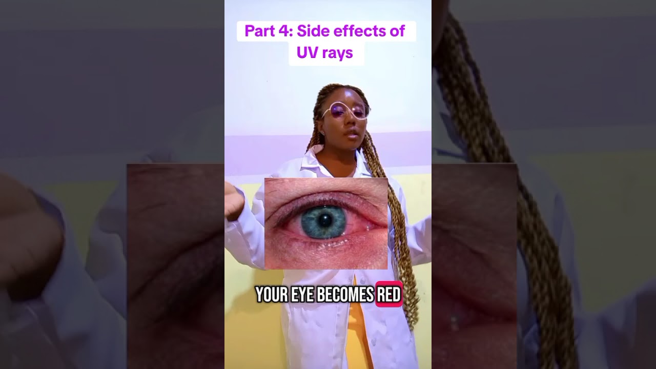 Side effects of UV rays 