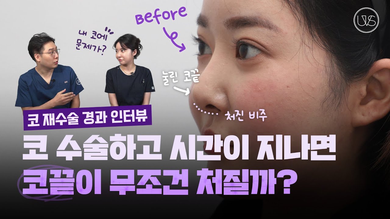 [Вивэрс Гоо сайхны мэс заслын эмнэлэг] Хамрын дахин мэс заслын дараах 3 жил! Хамрын хэлбэр ямар болсон бэ? Хамрын дахин мэс заслын 3 жилийн дараах ярилцлага