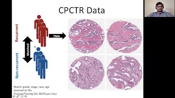AI Seminar: Neeraj Kumar, Computational Pathology – From Nuclei Segmentation to Precision Oncology