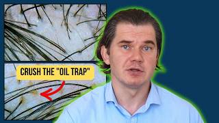 The Scalp Oil Trap: Why Blocking DHT Isn't Saving Your Hair