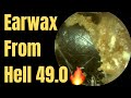 Earwax From Hell 49.0 🔥