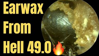 Earwax From Hell 49.0 🔥