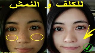 كيفية ازالة النمش و الكلف و البقع الداكنة من الوجه باستعمال مسحوق الصندل النتيجة مضمونة مليون بالمية