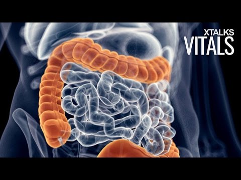 Food Additive Could Contribute To Development of Colon Cancer