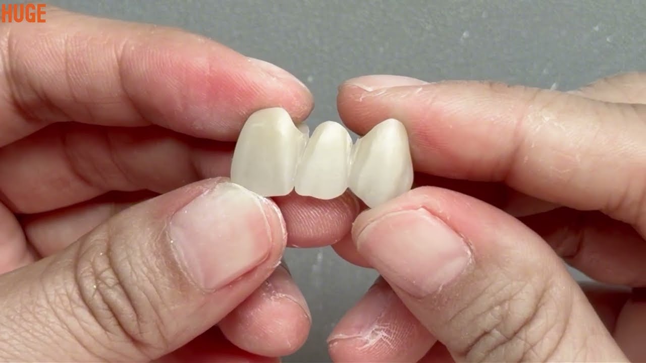 Technical Guide of Zirconia Grinding & Staining