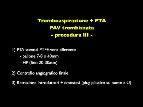Tromboaspirazione + PTA angioplastica protesi artero-venosa interventional nephrology AVF dialysis