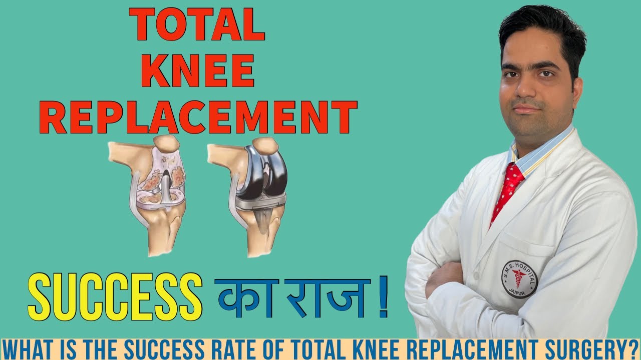 TOTAL KNEE REPLACEMENT SURGERY SUCCESS RATE TKR kneepain arthritis 