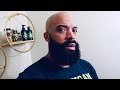 How to Raise the Beard Cheek-Line | 2 month UPDATE!! | Finish Line 🏁