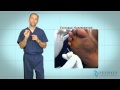 New Hammertoe Correction Procedure Performed in the Office