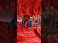 Spiderman giúp Vi Khuẩn bắn tơ nhện chói chặt hồng cầu