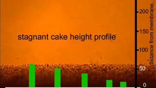 Direct Observation Of Fouling Deposition And Removal On Hollow Fibre Membrane Surface.