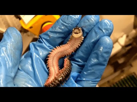 \"მონსტრები\" ჩვენს სხეულზე