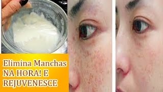 Nada de Manchas – Clareie Sua pele Com Este Econômico e Eficaz Ingrediente