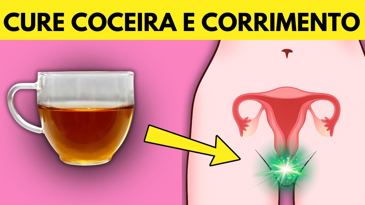 Livre-se da CANDIDÍASE e da COCEIRA Íntima se Fizer Isso
