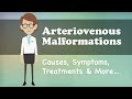 Arteriovenous Malformations - Causes, Symptoms, Treatments & More…