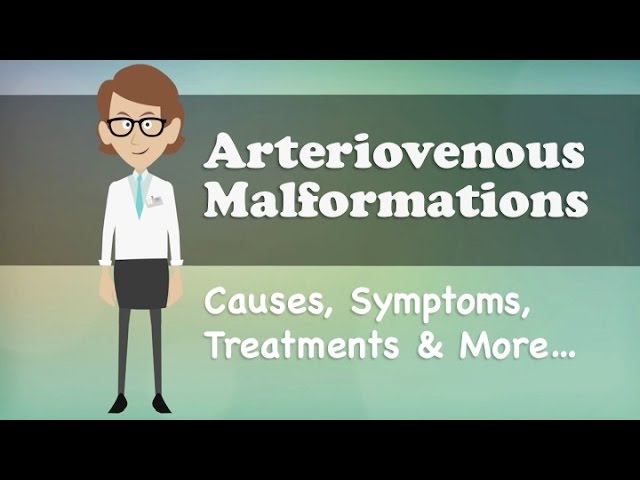 Arteriovenous Malformations - Causes, Symptoms, Treatments & More… class=