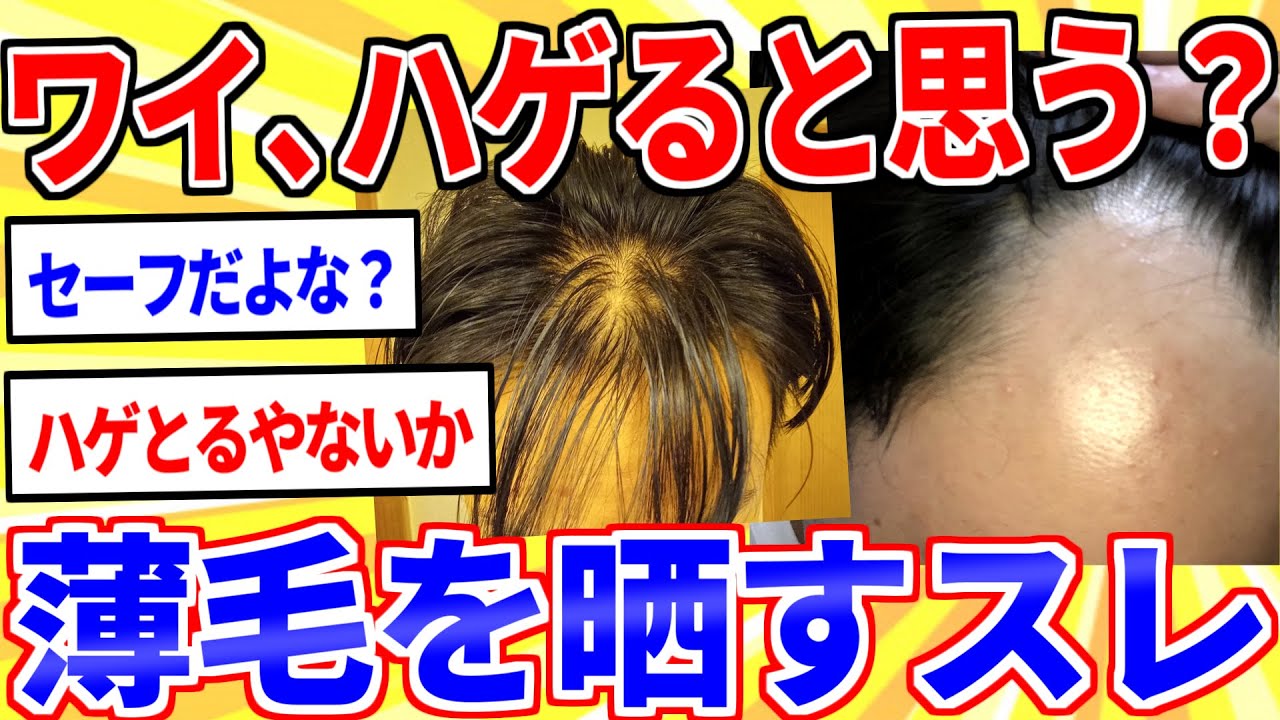 【2ch面白いスレ】薄毛スレ民大集合！ワイの髪、将来ハゲる可能性ある？【ゆっくり解説】