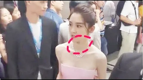 唐藝昕撈金滿臉笑容，脖子上的痕迹太明顯了，網友直呼：秒懂！ - 天天要聞