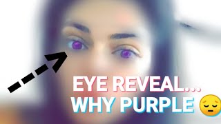 EYE Reveal... || Purple eyes 😔