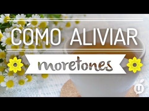 Video: ¿El calor es bueno para los moretones?