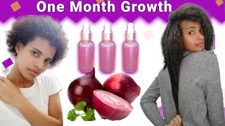 Onion Juice For Hair Growth BEFORE AND AFTER RESULTS