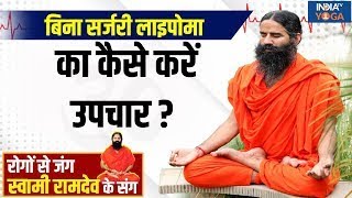 YOGA LIVE: बिना सर्जरी Lipoma का कैसे करें उपचार ? जानें Swami Ramdev से  | Yoga Tips | Lipoma