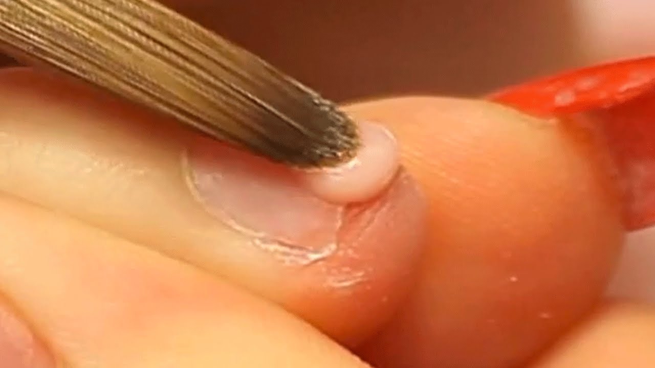 How To Apply Acrylic Nails On Short Bitten Nails Nail Tutorials Nail Tutorial Videos Sculptured Acrylic Nails