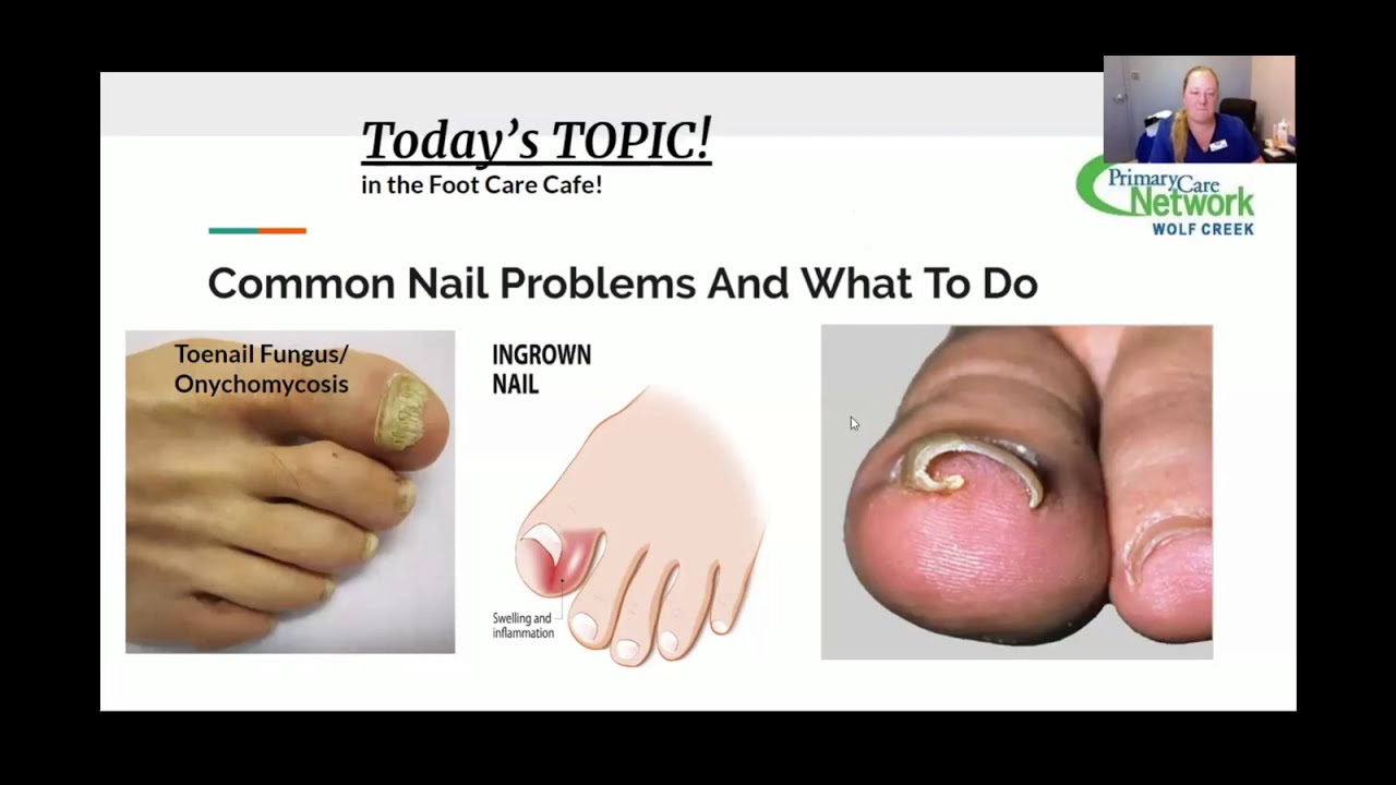 Toenail Problems – Mona Vale Podiatry