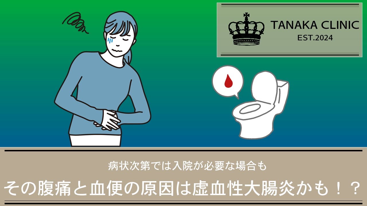 28　突然の腹痛と血便、その原因は？虚血性大腸炎かもしれません｜【胃腸と内視鏡の専門チャンネル】たなか内科クリニック