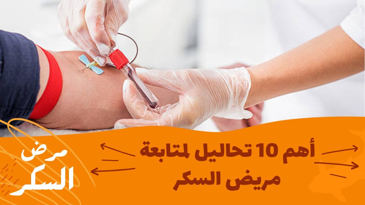 10 تحاليل مهمة جدا لمتابعة مريض السكر