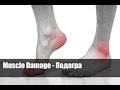 Muscle Damage   Подагра