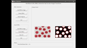 Count Red Blood Cells Matlab Source Code GUI